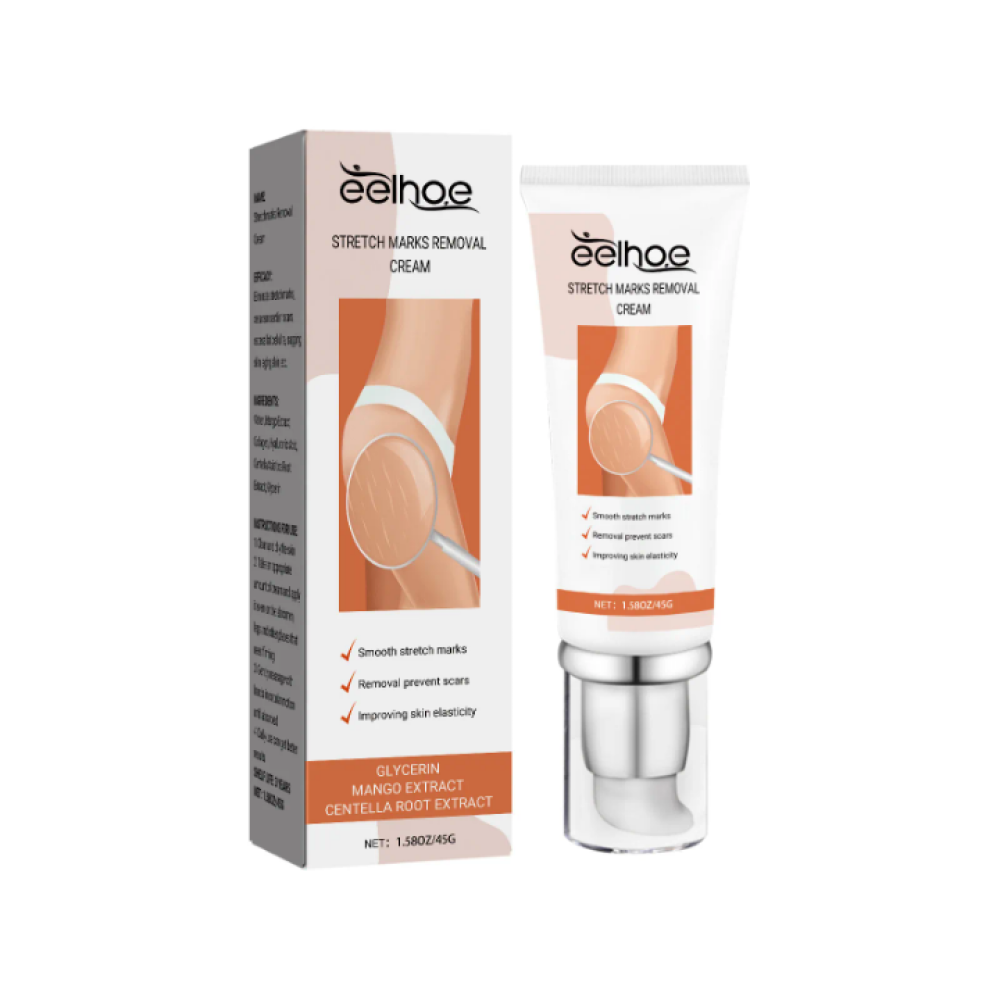 Stretch marks removal cream